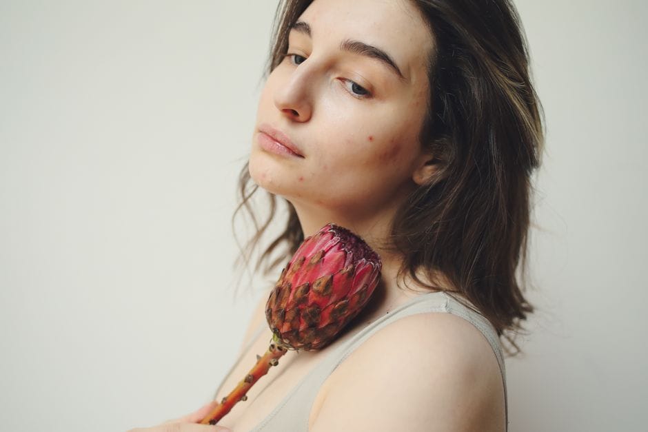 Building a rosacea-friendly routine