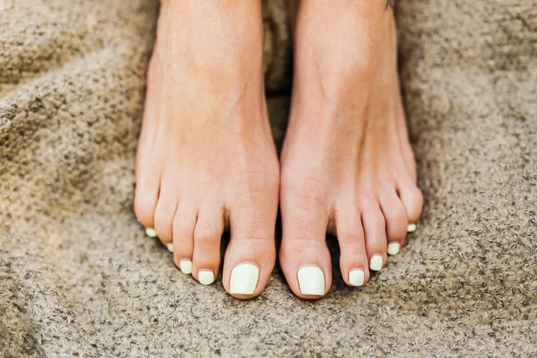 The Late-July Foot Reset: Fixing Sandal Season Damage Before August